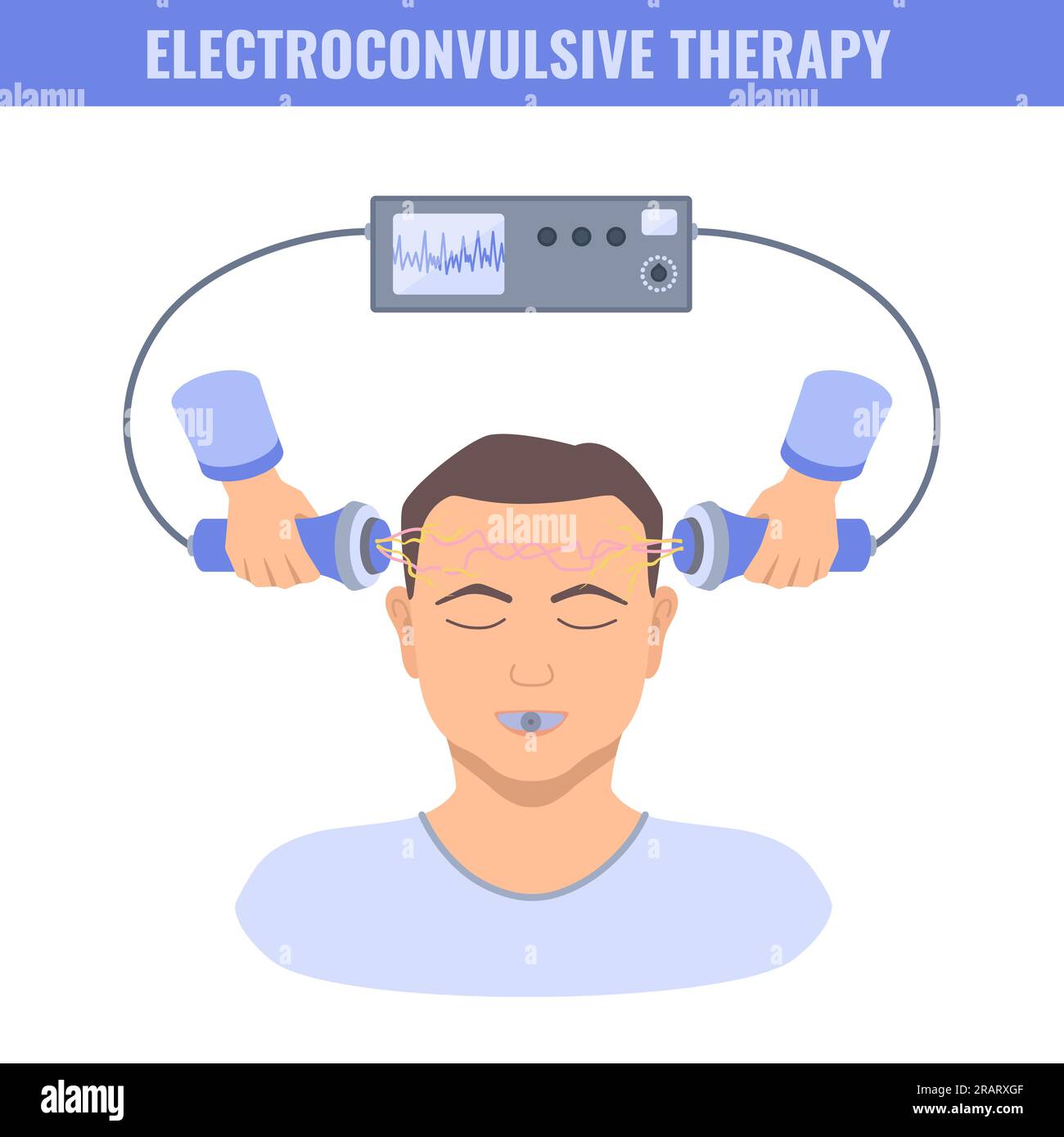 Electroconvulsive therapy for severe depression and schizophrenia