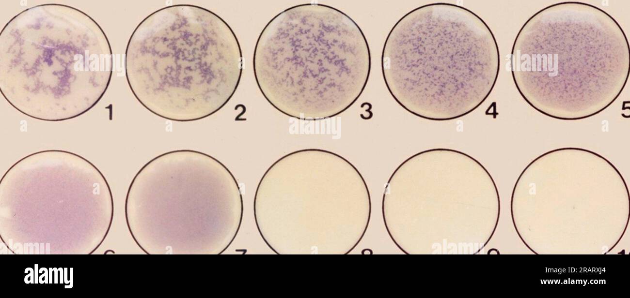 Agglutination technique hires stock photography and images Alamy