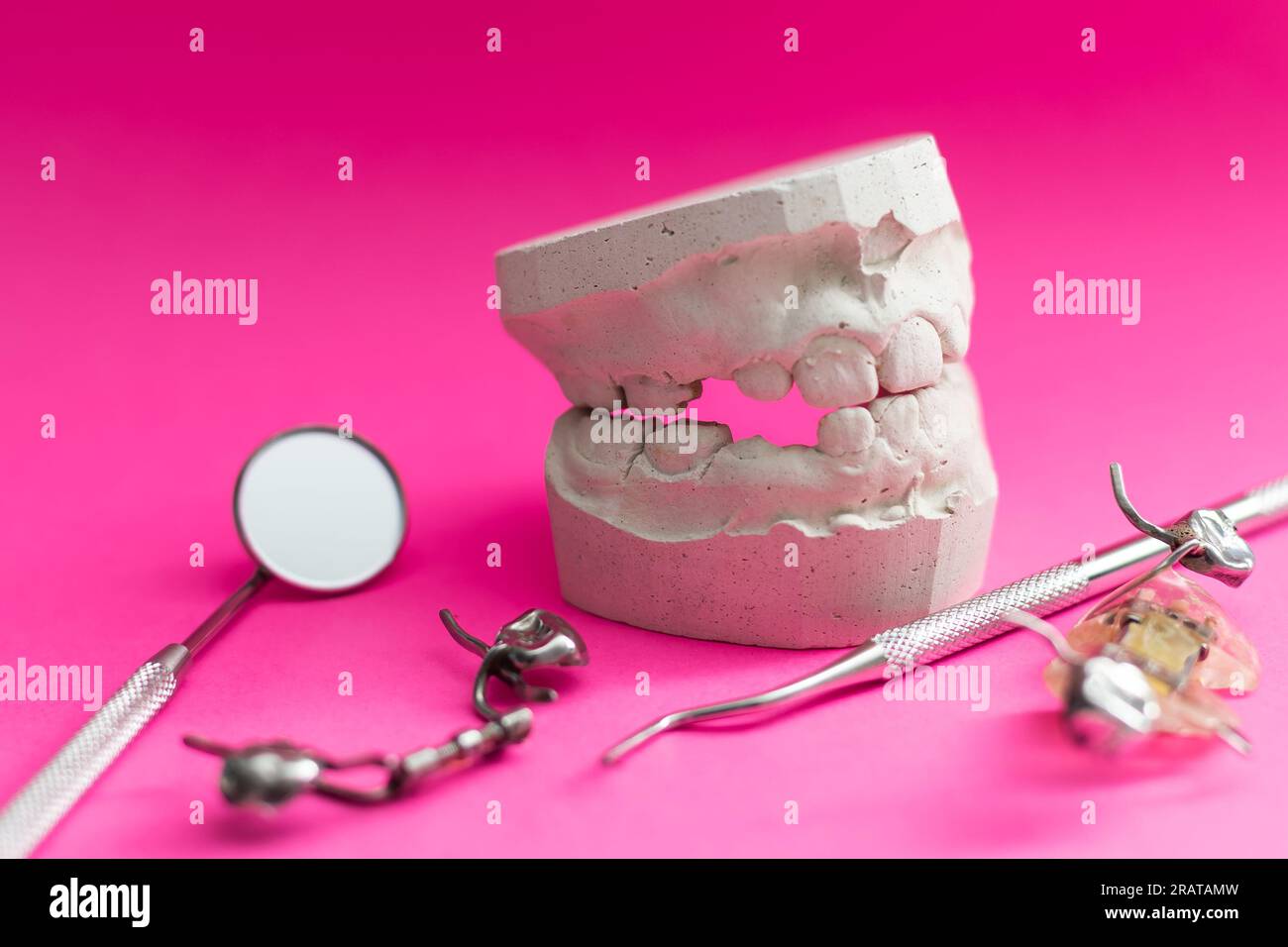 dental plates, dental plates for aligning teeth in a child Stock Photo