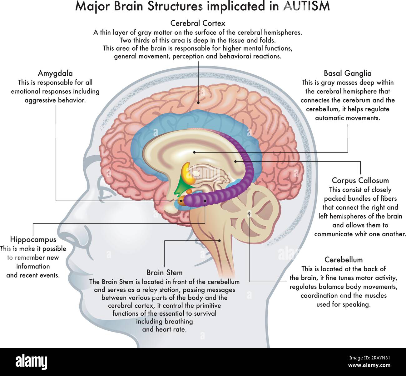 Medical Illustration Showing Major Brain Structures Implicated In Medical Illustration Showing Major Brain Structures Implicated In