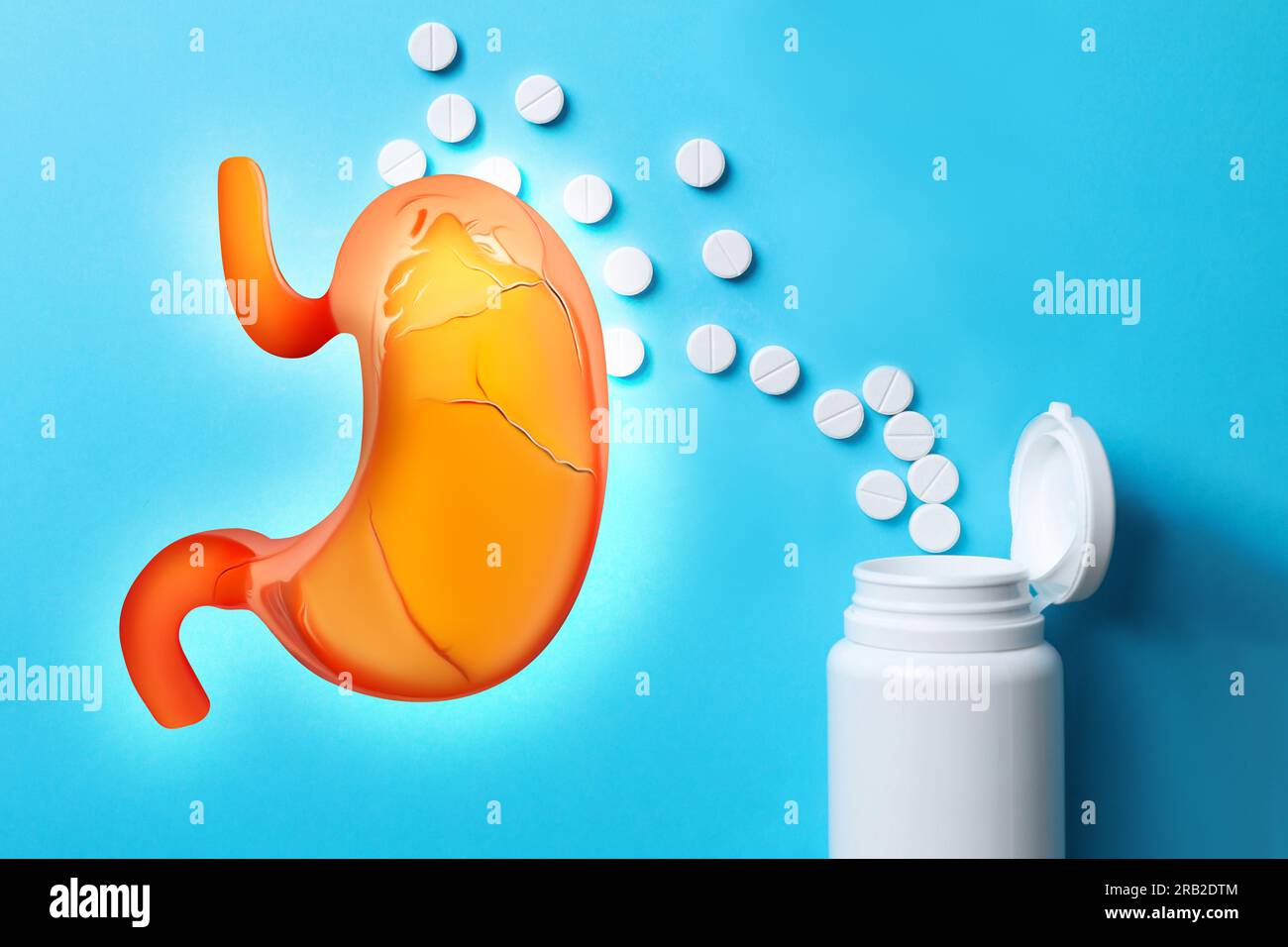 Heartburn treatment. Antacid pills and illustration of unhealthy