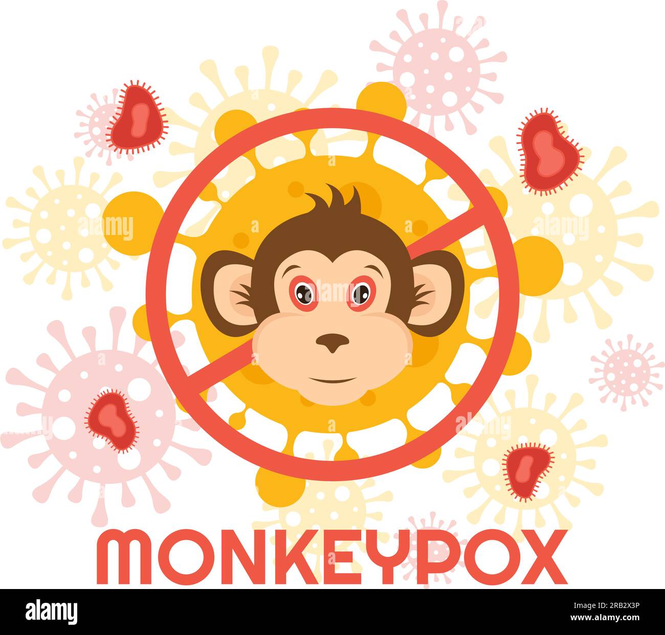 Monkey Pox Outbreak Vector Illustration of Virus Symptoms in Humans
