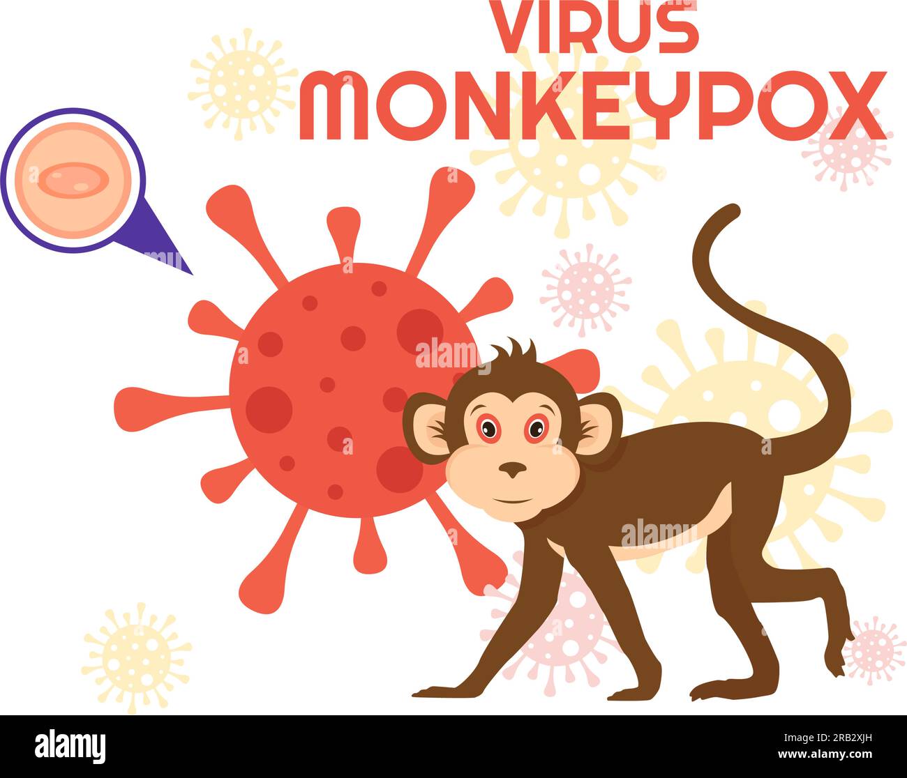 Monkey Pox Outbreak Vector Illustration of Virus Symptoms in Humans Monkeypox Microbiological in Flat Cartoon Hand Drawn Templates Stock Vector