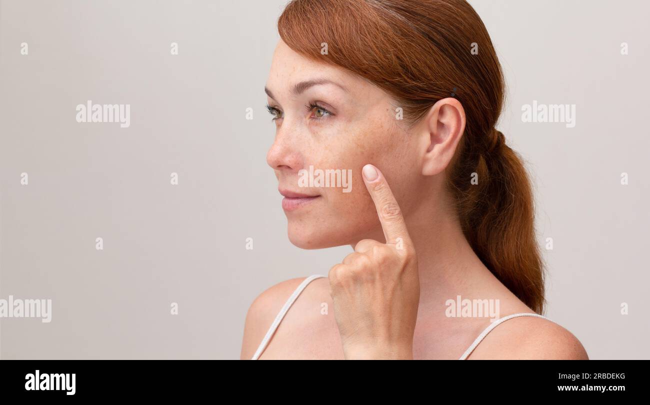 Portrait of cropped caucasian middle aged woman face with freckles showing on skin by index finger on white background looking aside Stock Photo