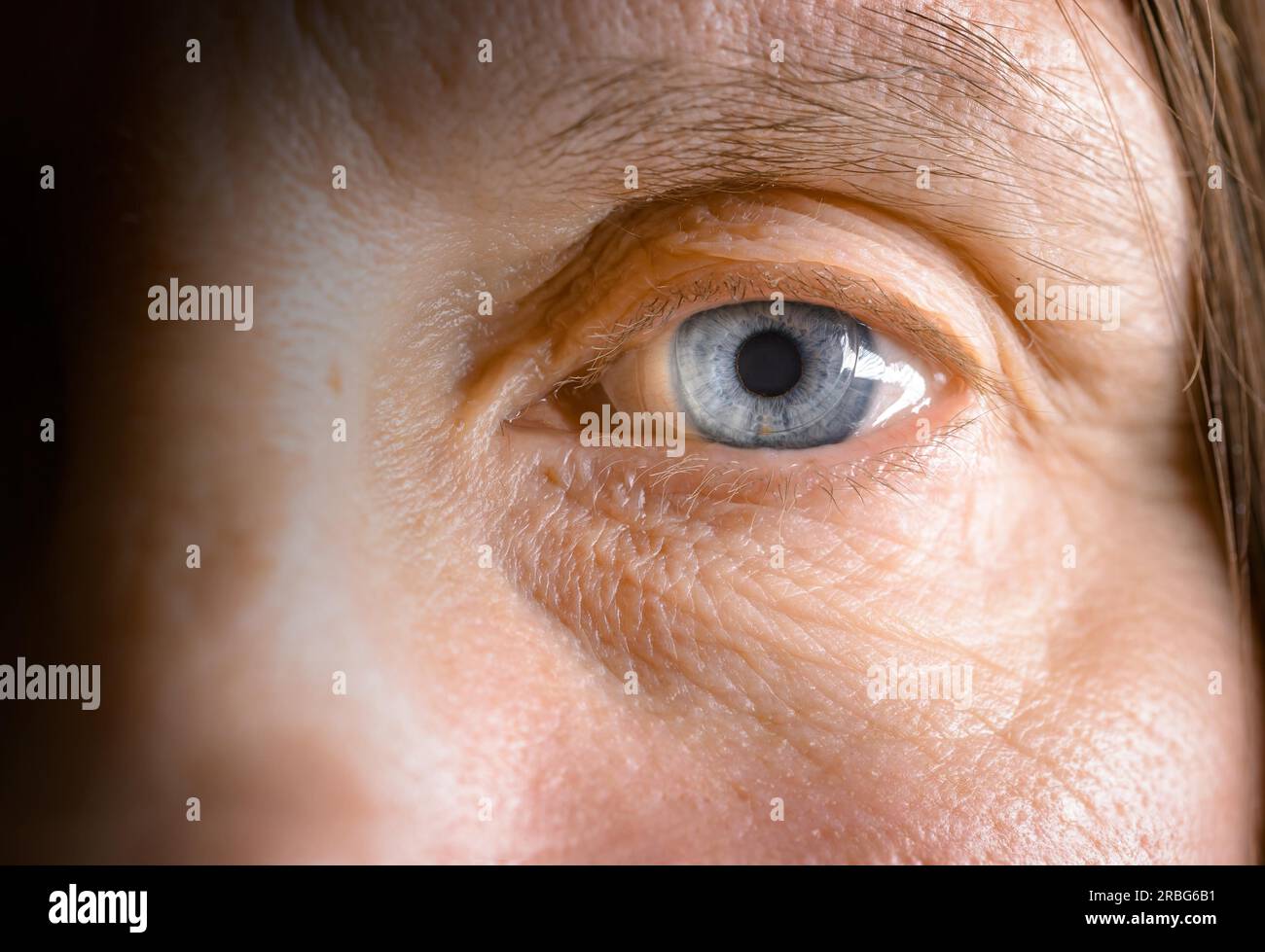 Close up of a woman's blue eye with a hard contact lens Stock Photo Alamy