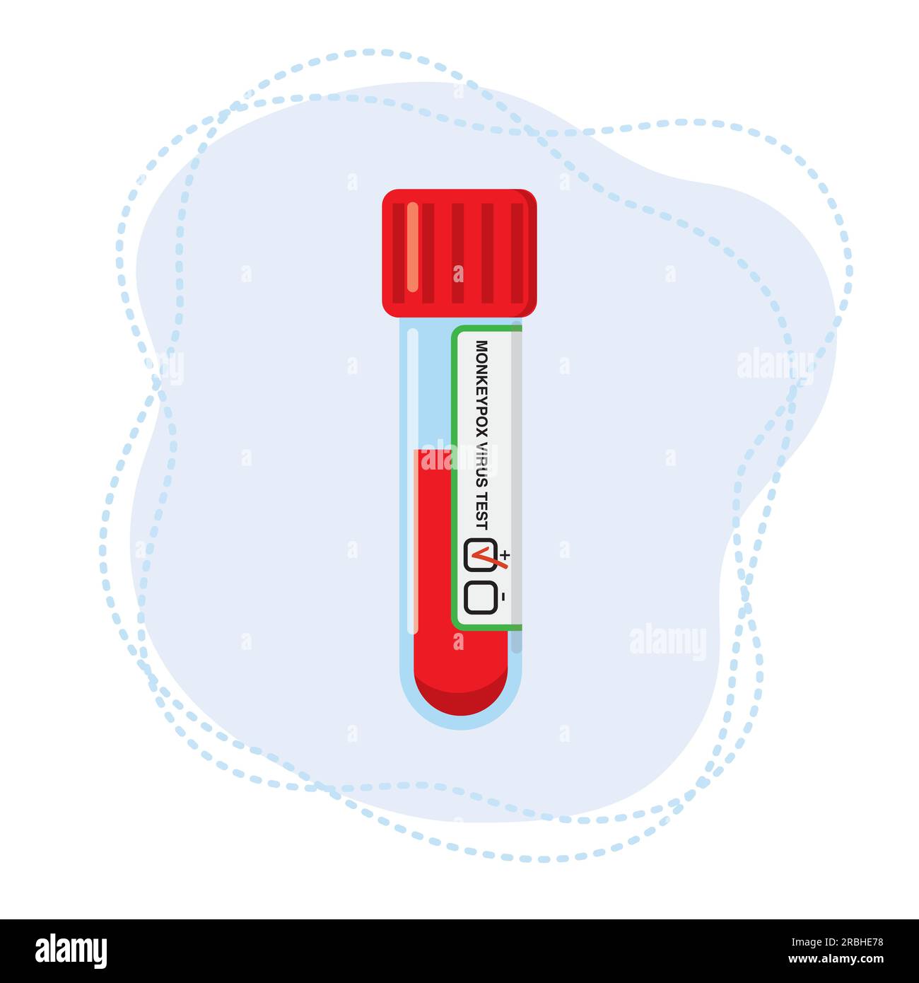Test tube with blood for the determination of the monkeypox virus Stock ...