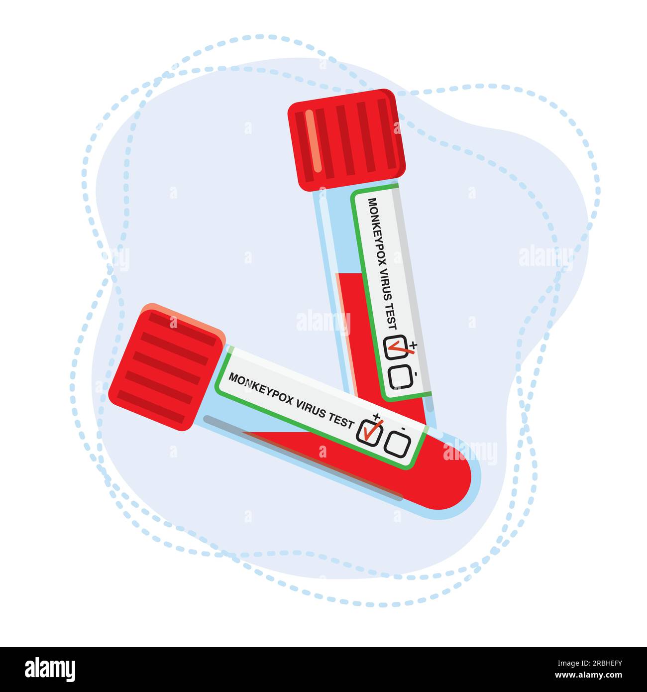 Two test tubes for a blood test to determine the monkeypox virus Stock