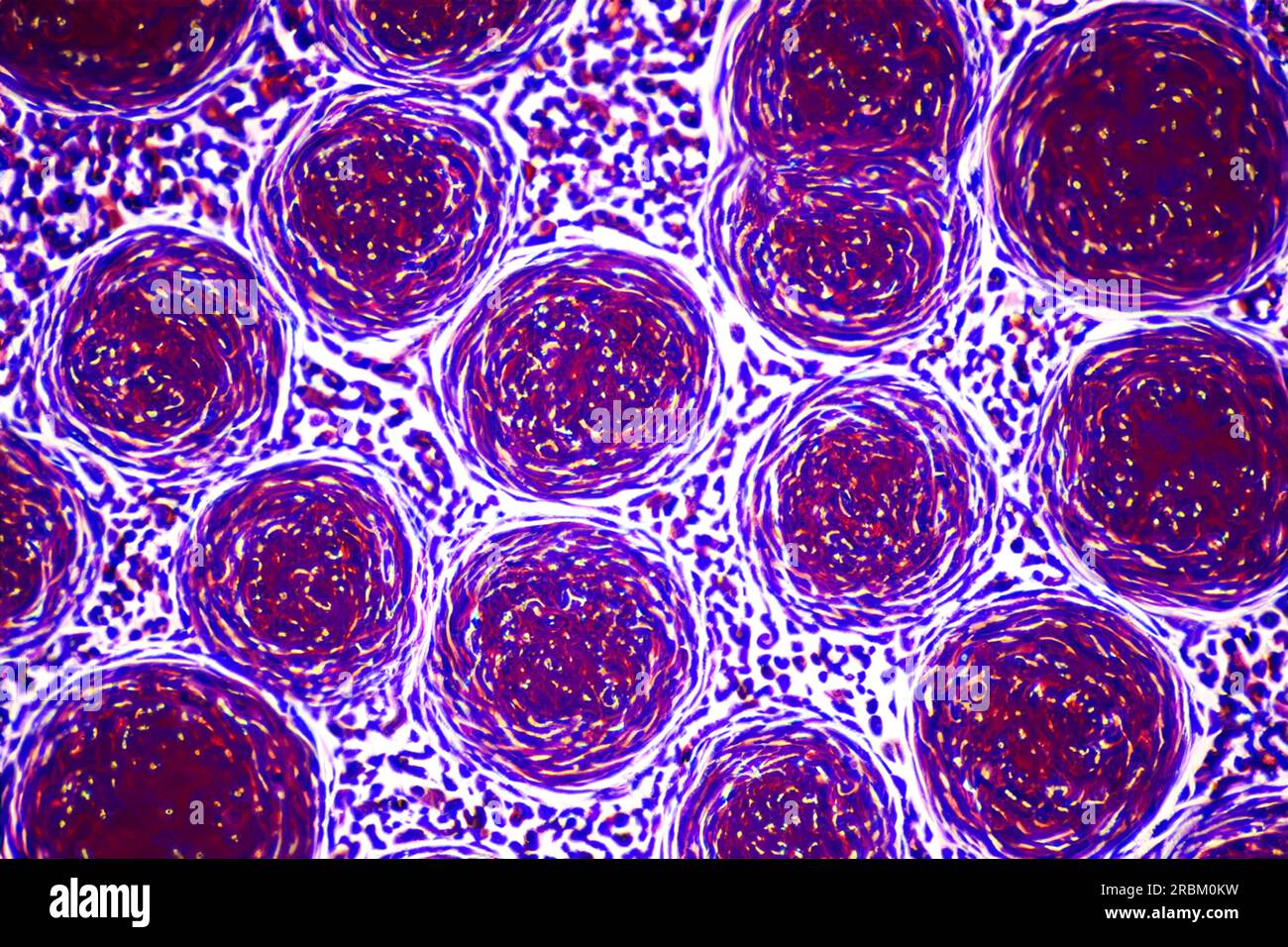 blood cells visible under a microscope Stock Photo Alamy