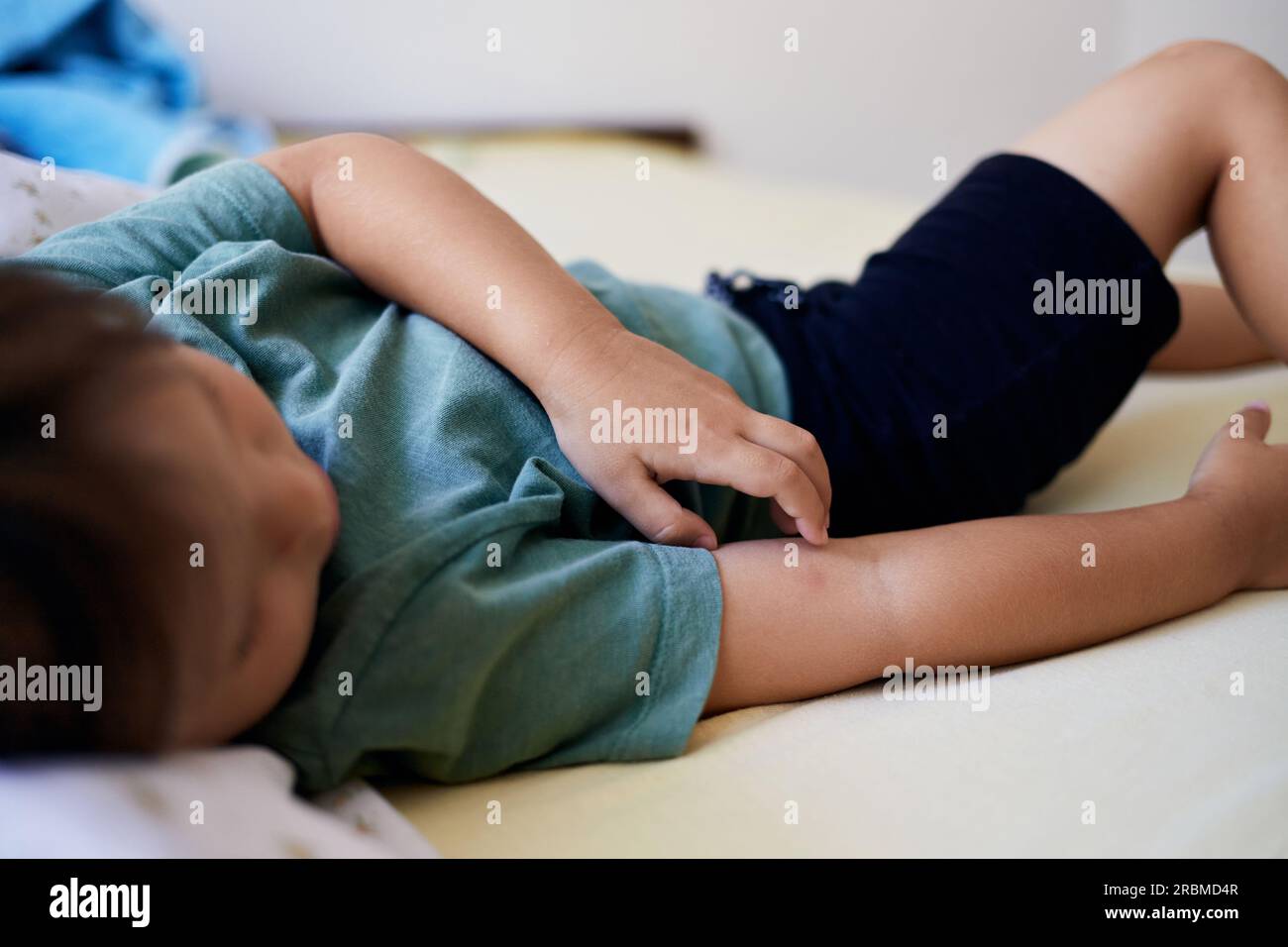 Mosquito bites sore and scar on child hand, a boy scratching at lesion Stock Photo Alamy