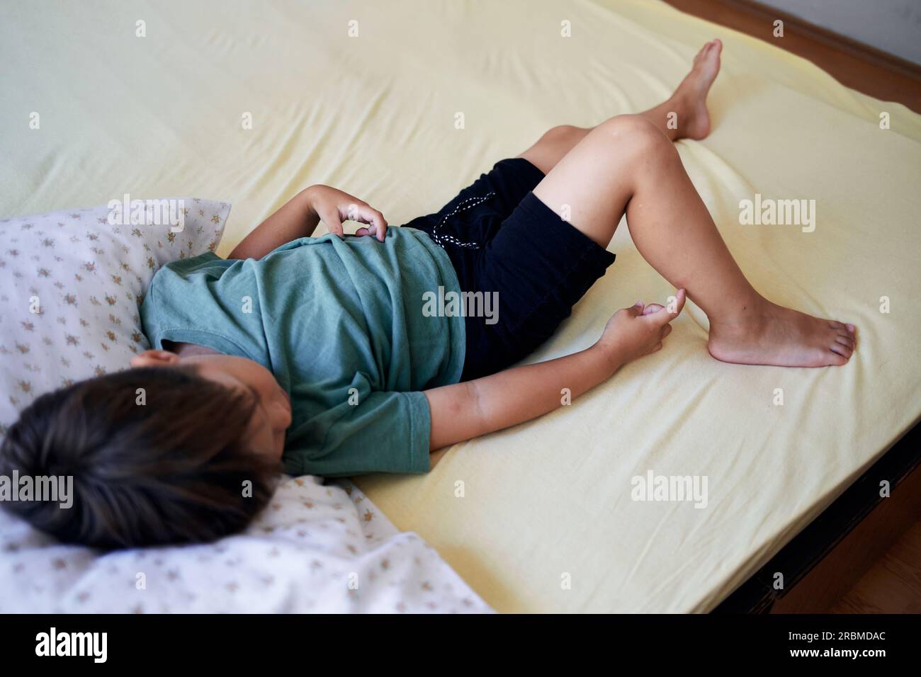 Mosquito bites sore and scar on child leg, a boy scratching at lesion. Stock Photo