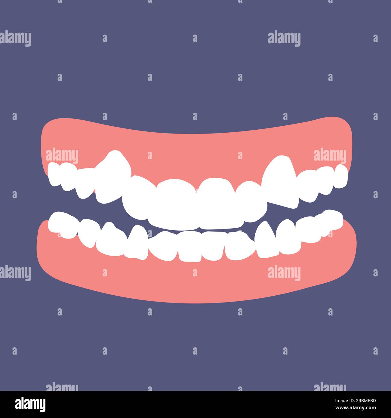 Dental crowding Stock Vector Images - Alamy