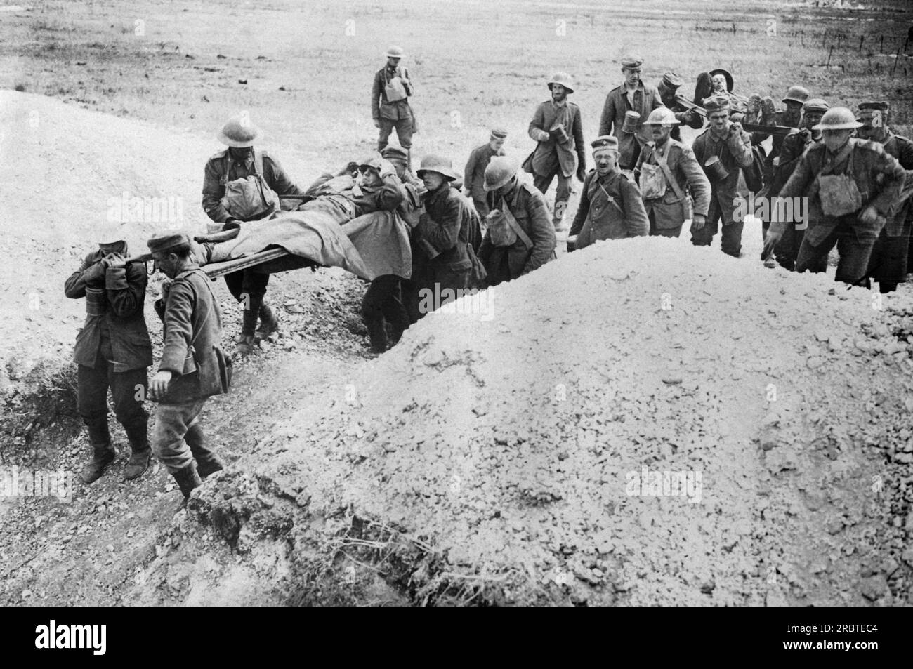 Europe: September 26, 1918 Wounded Canadian soldiers within the ...