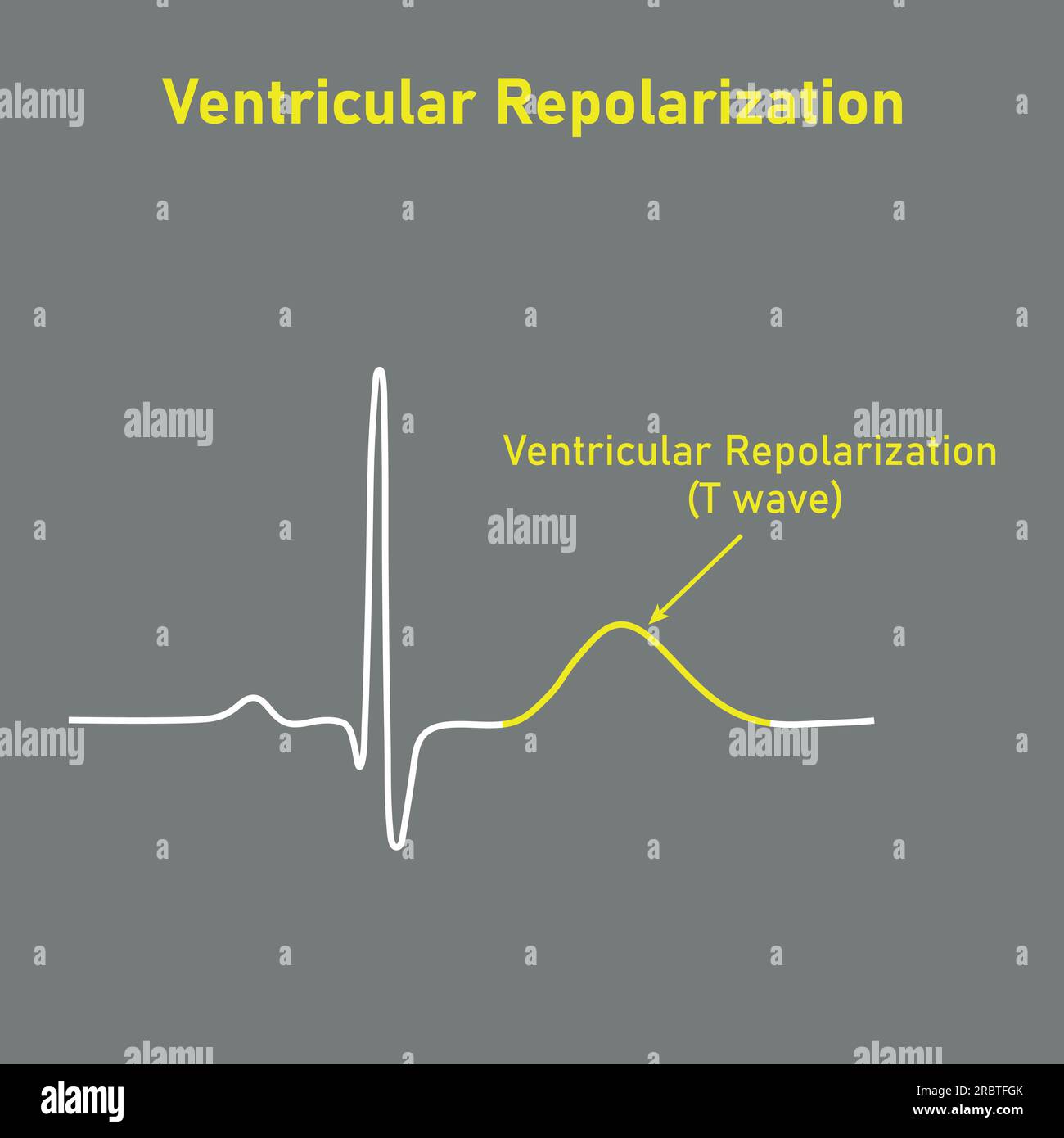 Ventricular repolarization, T wave. The QT interval of ECG. The cardiac cycle. ECG of a heart in normal sinus rhythm. Resources for teachers and stude Stock Vector