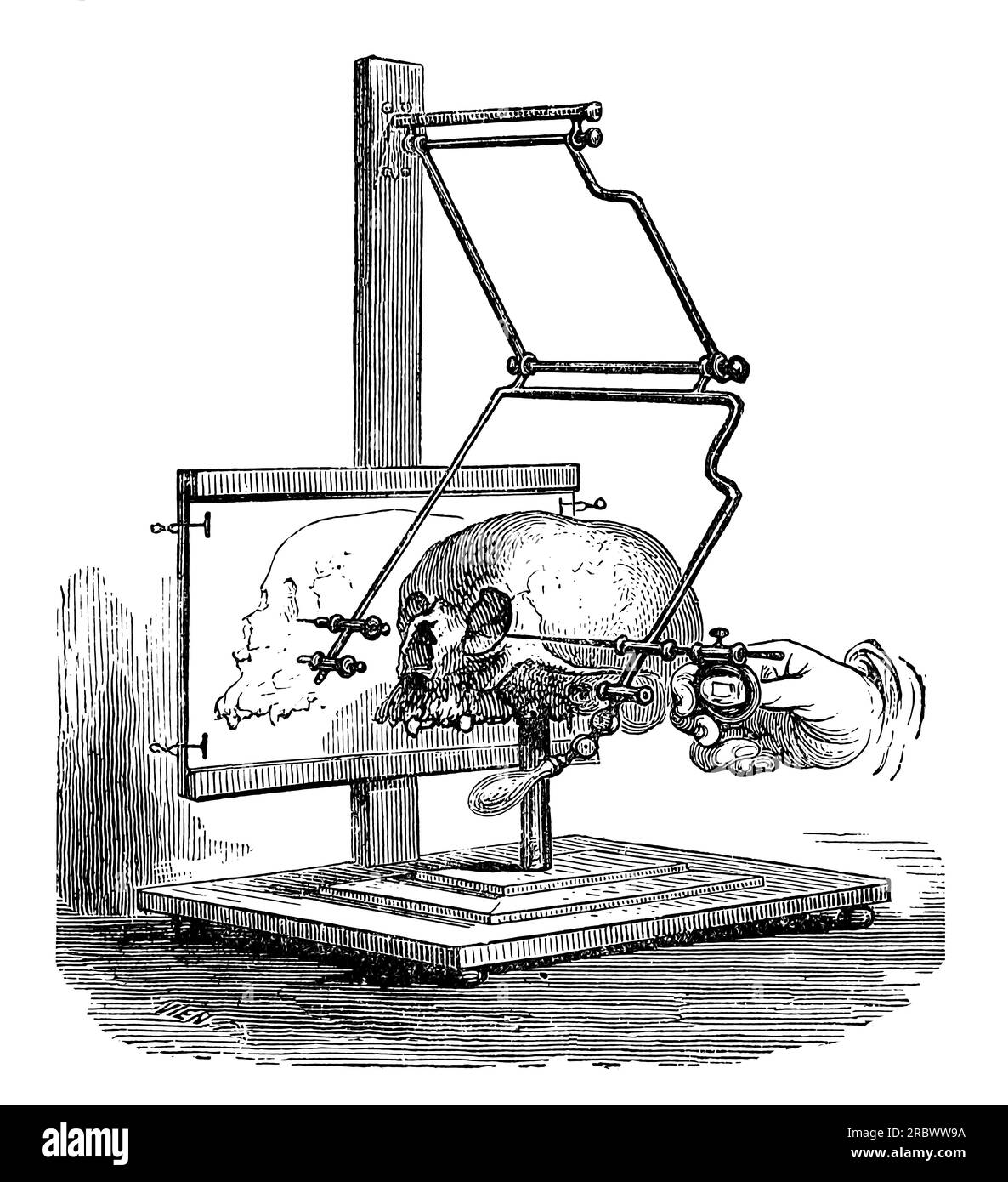 Stereograph designed by Pierre Paul Broca and manufactured by Mathieu Stock Photo