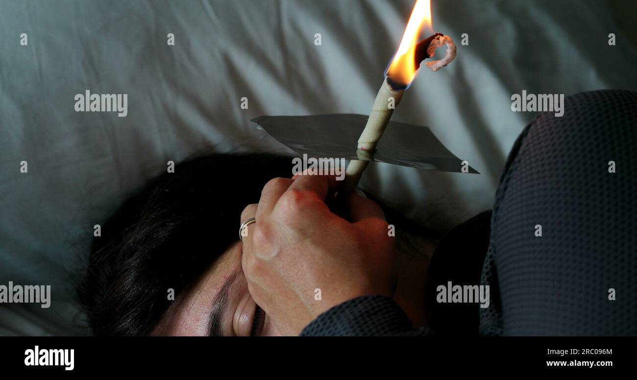 Burning cone ear wax removal ear candling Stock Photo Alamy