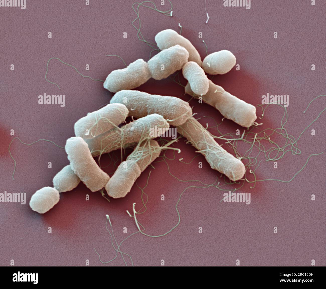 Proteus mirabilis bacteria, SEM Stock Photo - Alamy