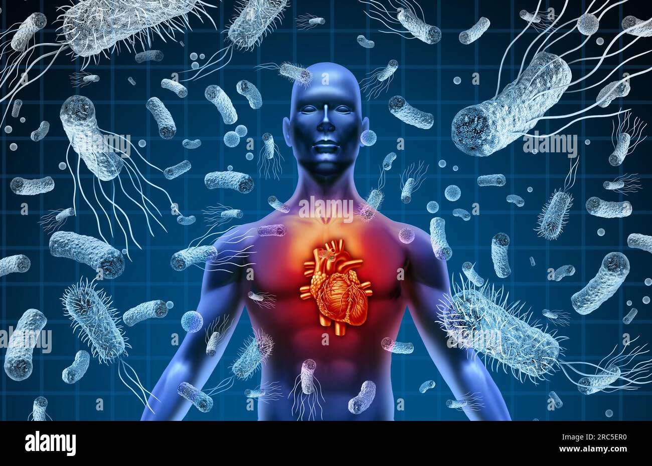 Heart And Bacteria or Bacterial Endocarditis and septicemia or sepsis as blood poisoning due to germs with 3D illustration elements. Stock Photo