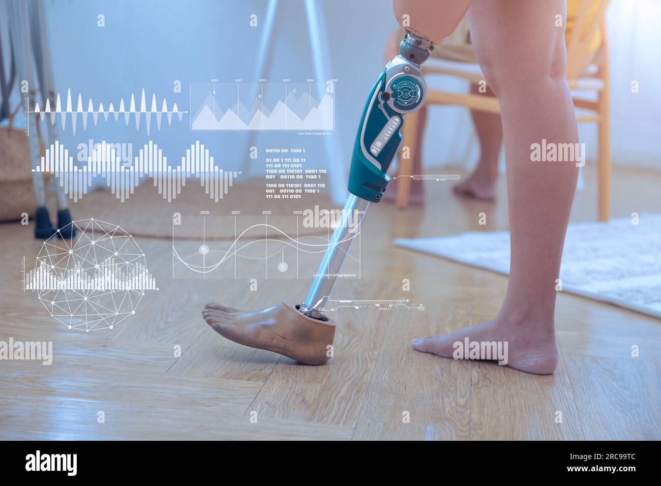 modern technology in prosthetic leg for disability people. robotic artificial knee joint bionic limb with data sensor overlay graphic Stock Photo