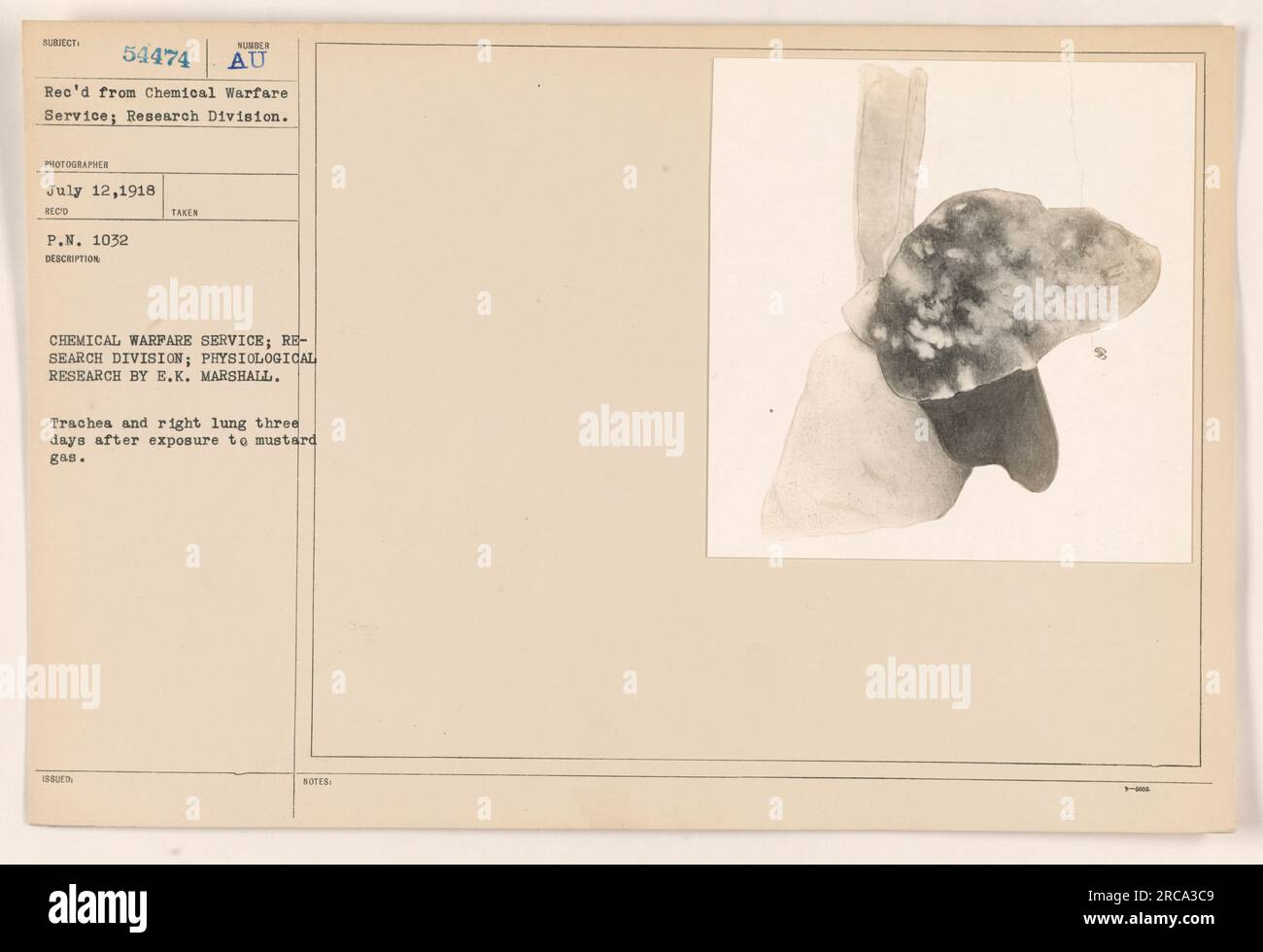 Photograph showing the trachea and right lung of a subject three days after exposure to mustard gas, as part of research conducted by the Chemical Warfare Service, Research Division. Captured on July 12, 1918, and received under Subject 54474 from the Chemical Warfare Service. The purpose of the photo is to document the physiological effects of mustard gas. Stock Photo