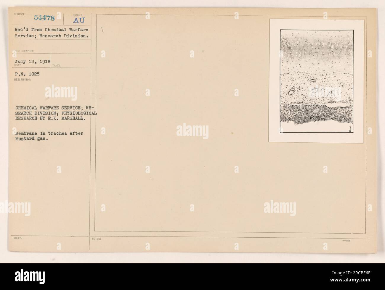 Photograph showing the effects of Mustard gas on the trachea's membrane. It was taken by the Chemical Warfare Service's Research Division, specifically by E.K. Marshall. Captured on July 12, 1918, the image serves as evidence of the physiological research conducted during World War I. Stock Photo