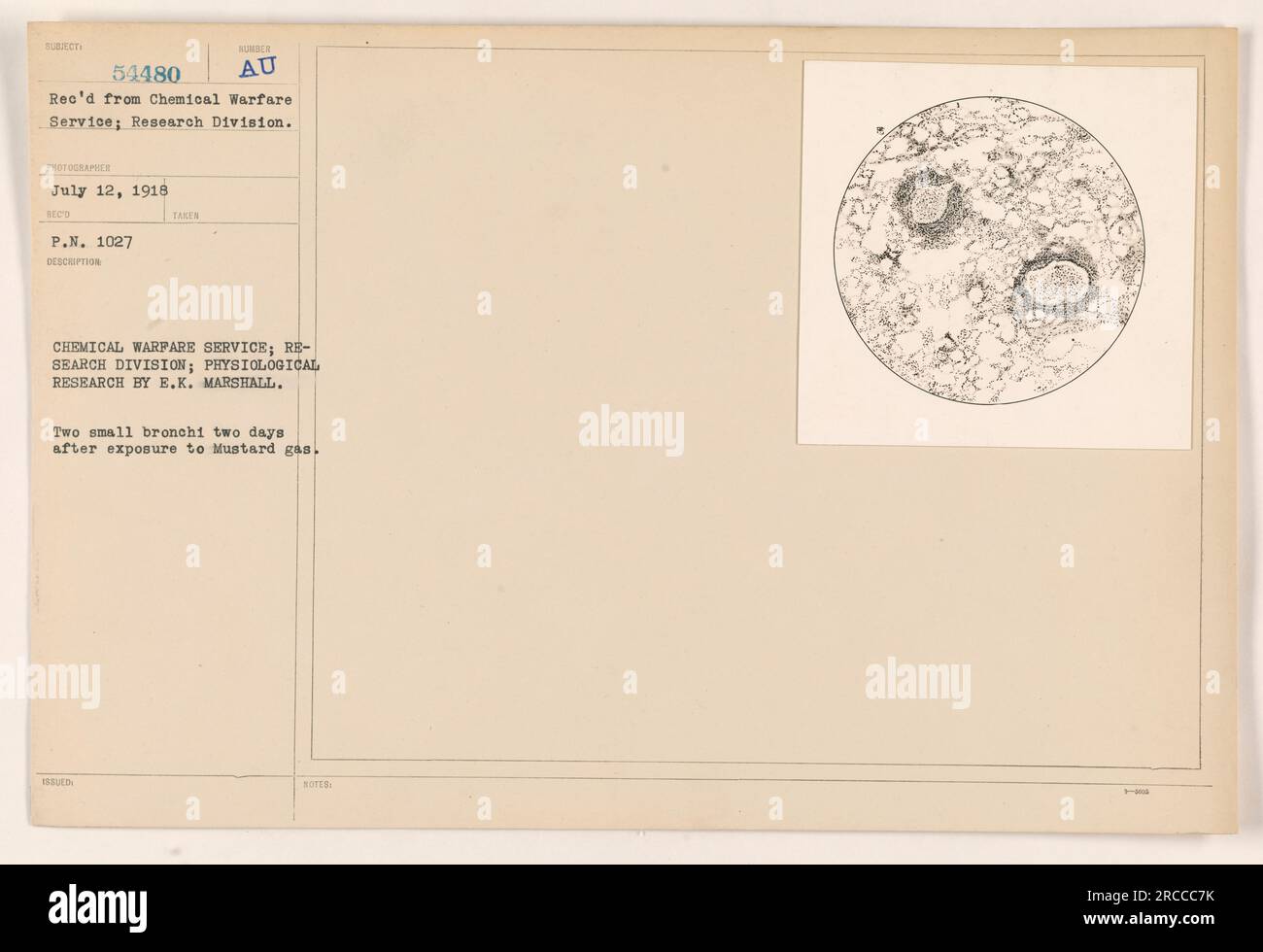 Photograph showing the aftermath of mustard gas exposure on two small bronchi, taken as part of the Chemical Warfare Service's physiological research conducted by E.K. Marshall. The photo was received from the C.W.S. Research Division on July 12, 1918, with the reference number SUBIECT 54480 AU P.N. 1027. Stock Photo