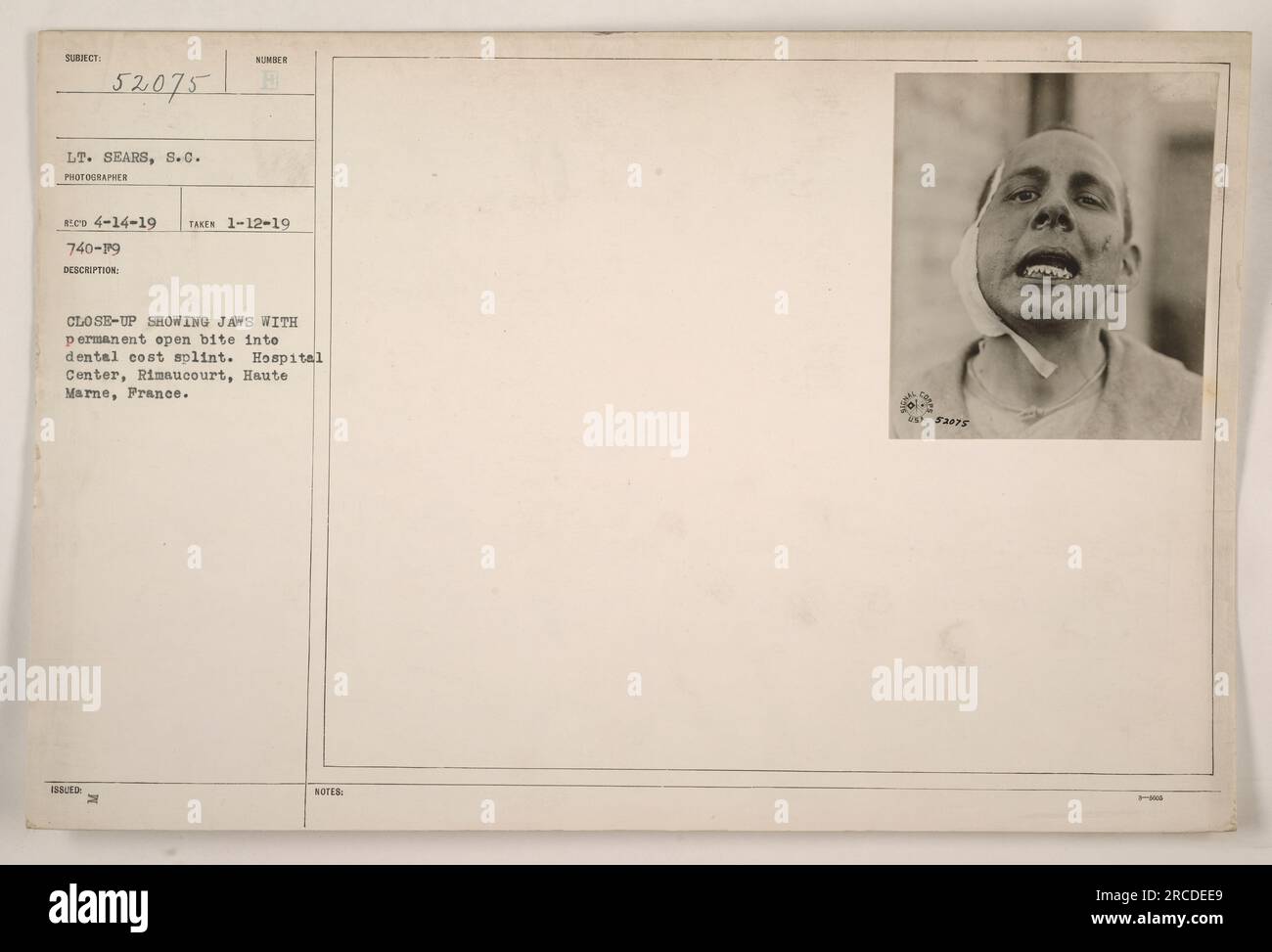 Dental cost splint hires stock photography and images Alamy