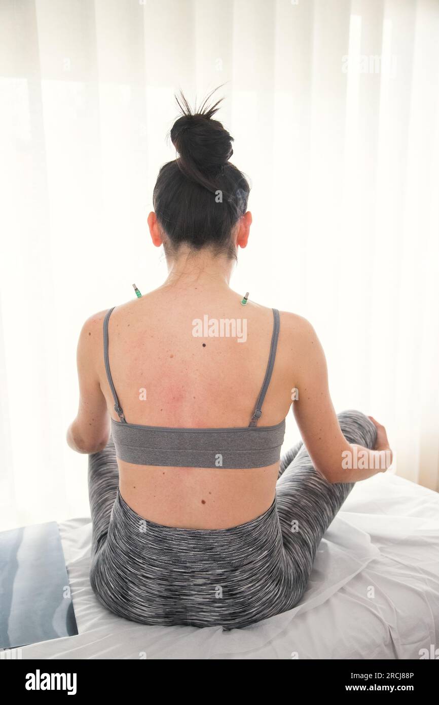Woman being applied a therapeutic technique of traditional Chinese medicine using heat on certain parts of the body, moxibustion.Pain relief treatment Stock Photo