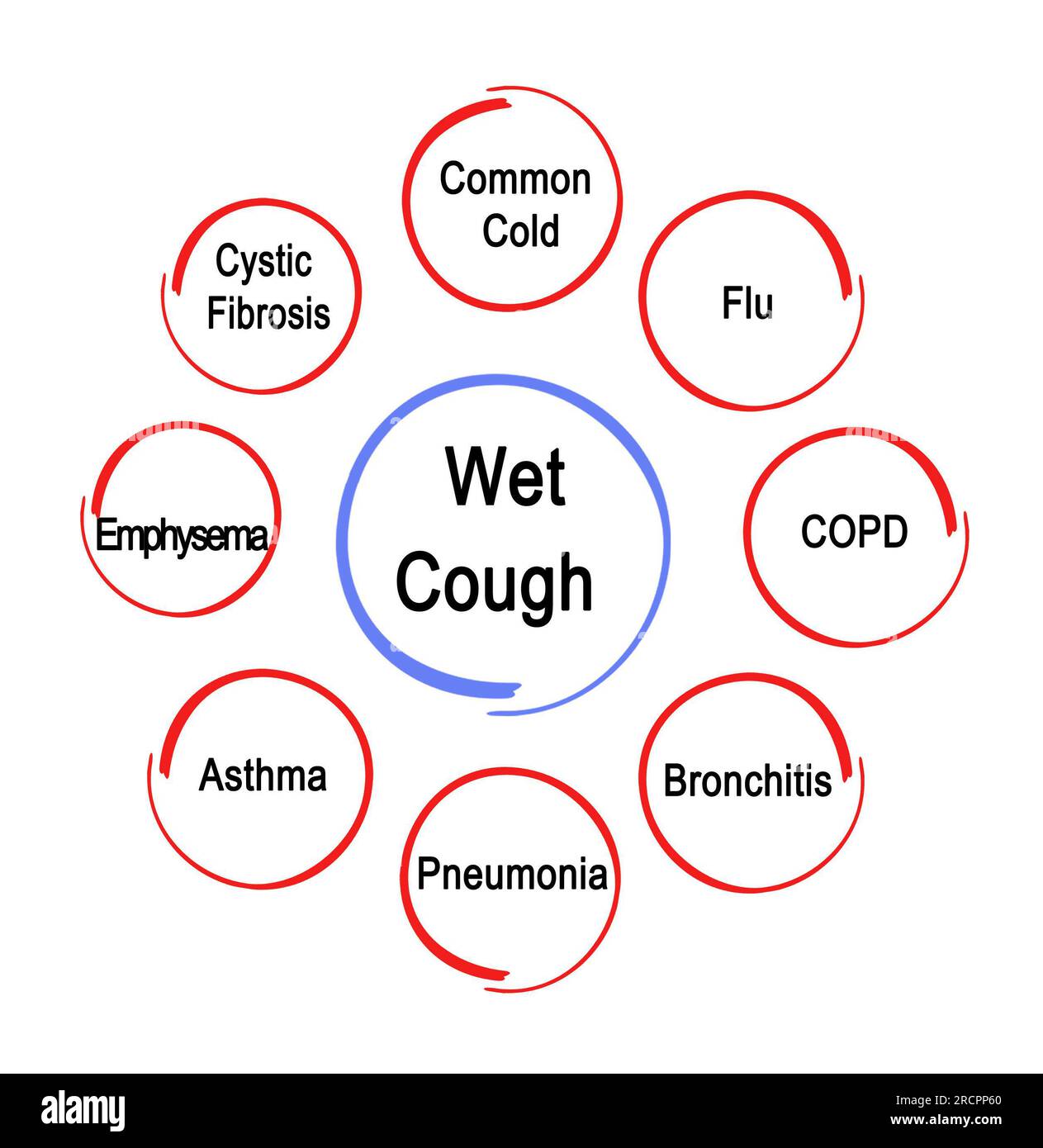 Eight Causes of Wet Cough Stock Photo Alamy