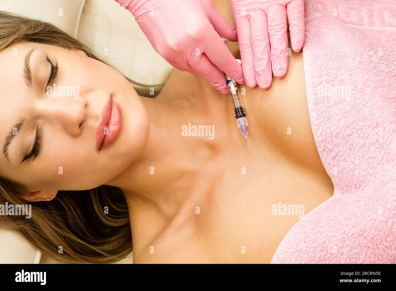 Temporary Lift Long Lasting Filler Results