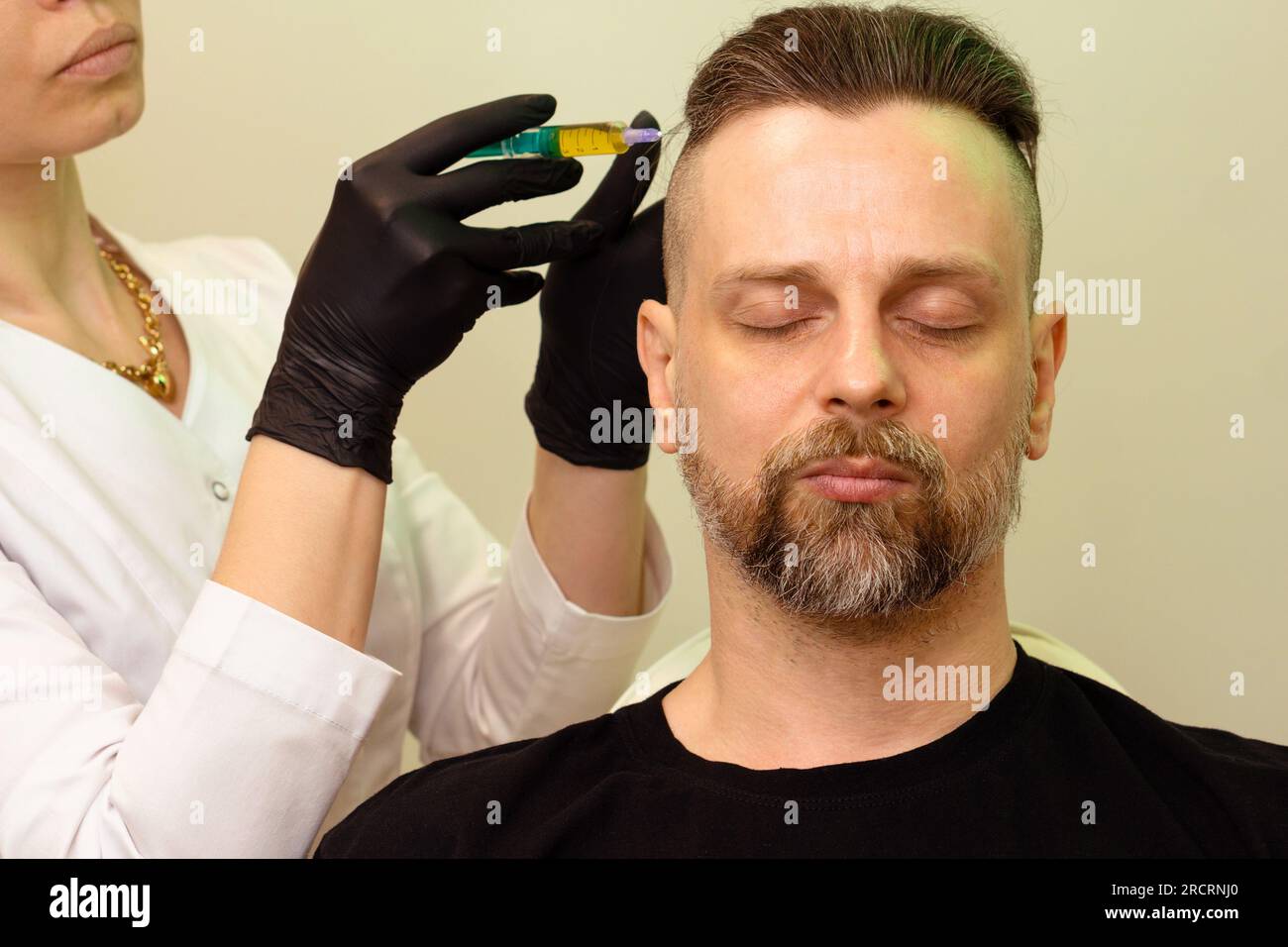 Esthetician uses thin needle to inject PlateletRich Plasma in scalp