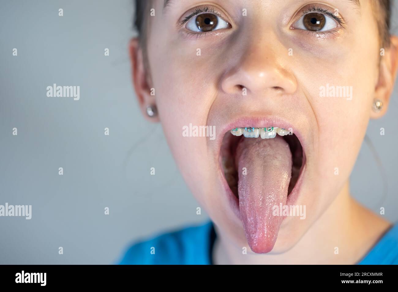 A child girl open her mouth and show her tounge Stock Photo Alamy