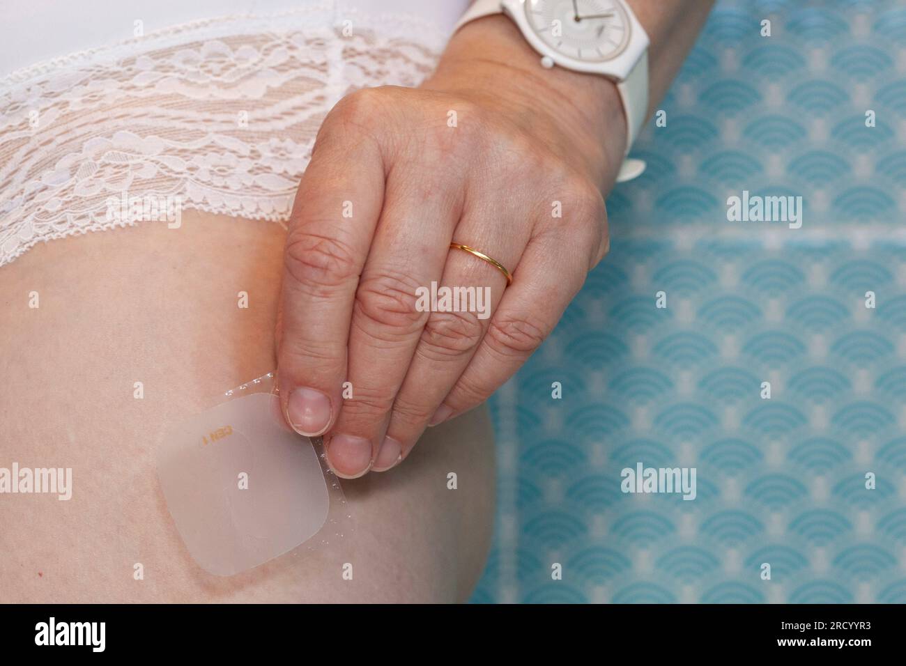 A white woman in her mid-50s applies an EvorelConti HRT patch to her upper leg. She is wearing white pants and standing in front of blue tiles. Stock Photo