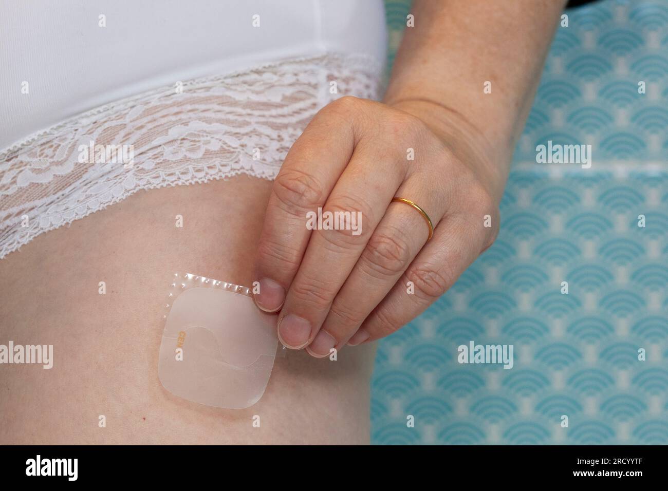 A white woman in her mid-50s applies an EvorelConti HRT patch to her upper leg. She is wearing white pants and standing in front of blue tiles. Stock Photo