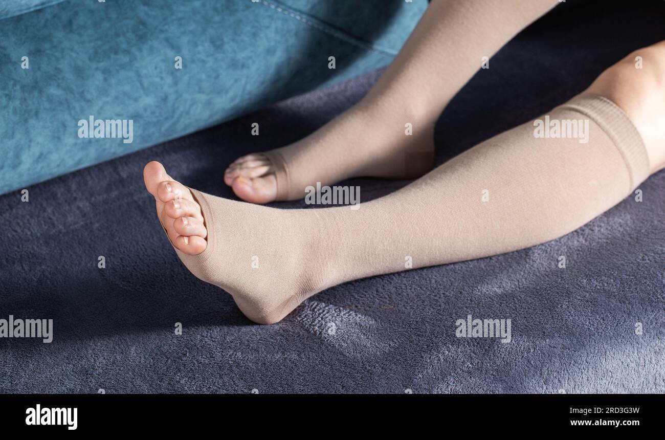 Girl's legs in compression stockings for varicose veins. Pregnancy and