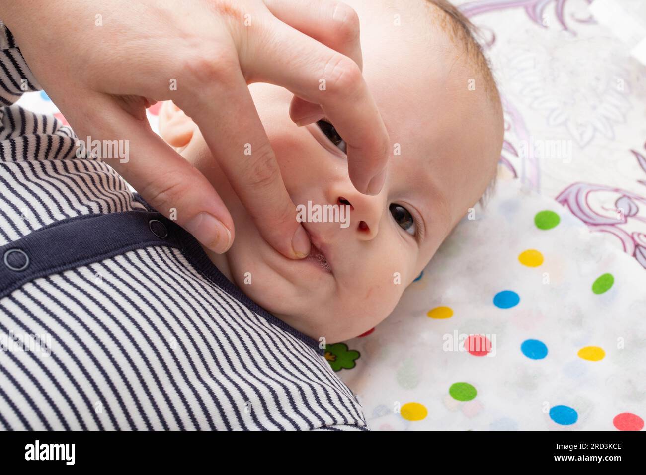 Mother applies anesthetic gel and massages teething gums to baby, close