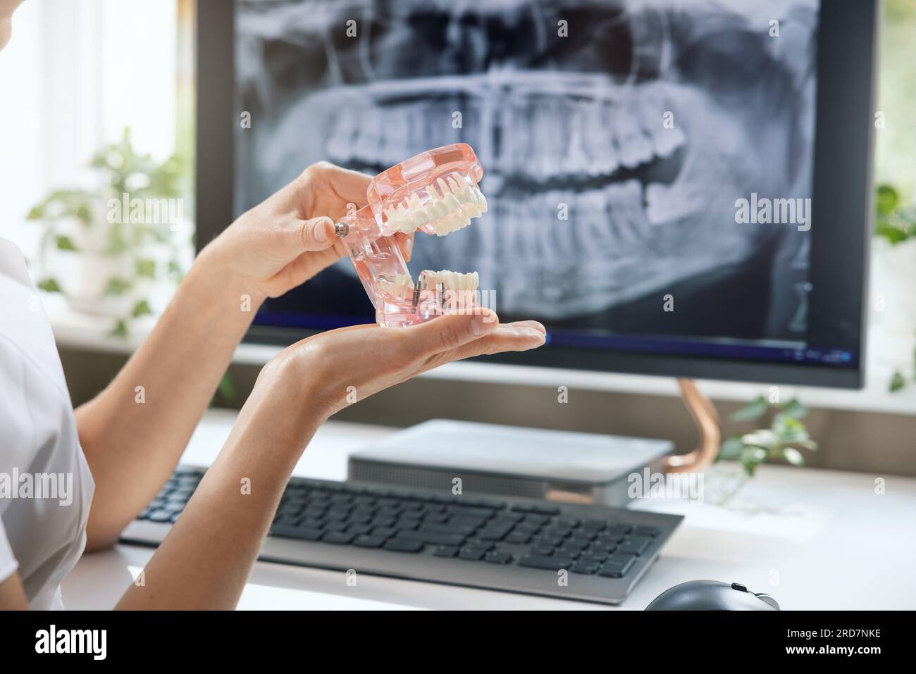 dentist implantologist showing teeth model with implant screw sample in