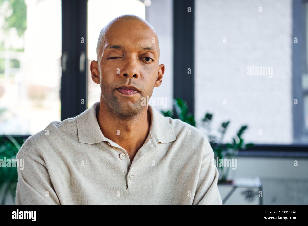 professional headshots, bold dark skinned man with myasthenia gravis disease looking at camera, african american office worker with ptosis eye syndrom Stock Photo