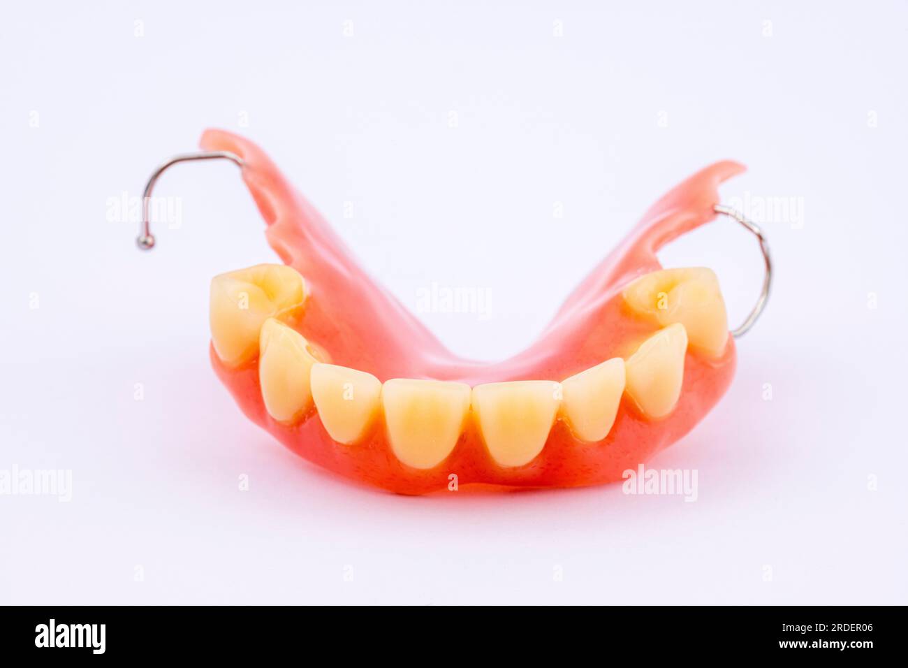 Removable denture of an upper jaw, denture, dental prosthesis, dentist