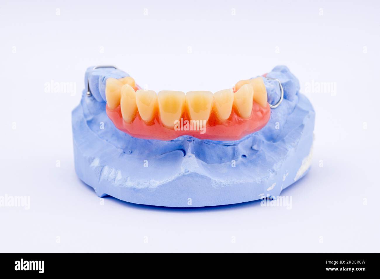 Removable denture of an upper jaw, denture, denture, dentist, dental impression Stock Photo