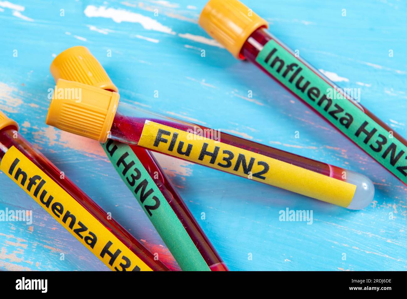 Test tubes with blood samples of Hepatitis virus, HIV, Hepatitis B