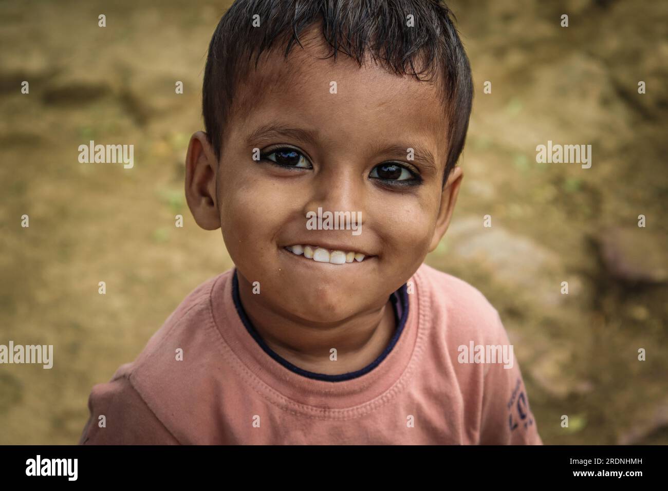 village boy showing unbrushed teeth Stock Photo