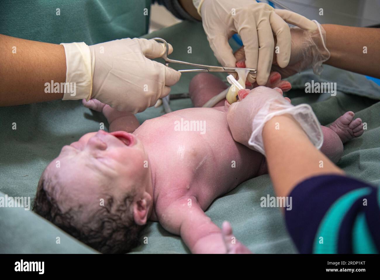 New born baby - girl with remainder of umbilical cord after successful  childbirth. Real birthing and new