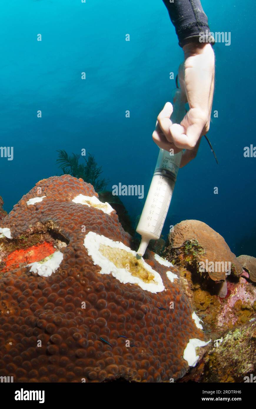 Marine biologist using antibiotic to treat sick great star coral affected by Stony Coral Tissue Loss Disease (SCTLD) Stock Photo