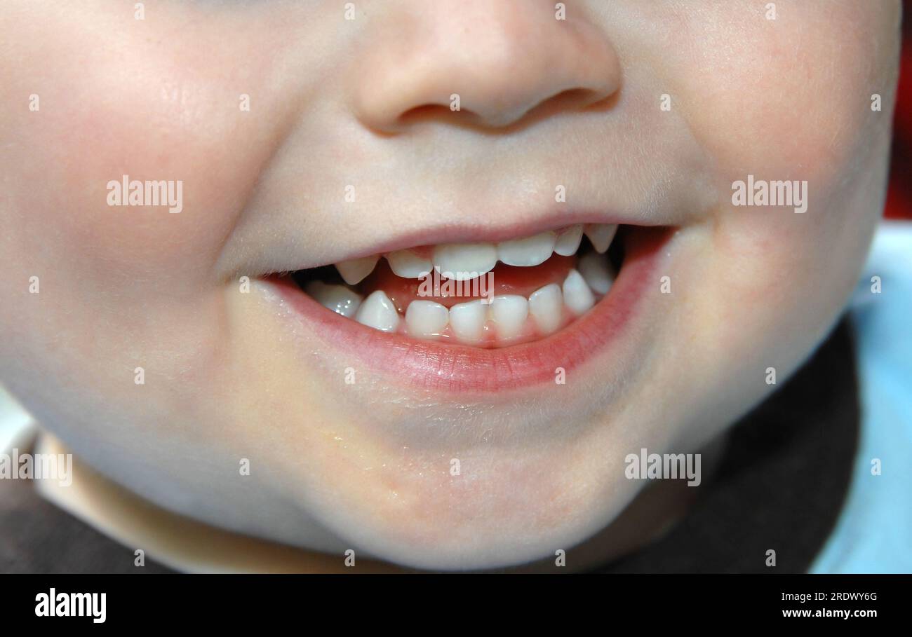 Pearl colored baby teeth grace the smile on this little toddler.  Closeup shows teeth, chin and mouth. Stock Photo