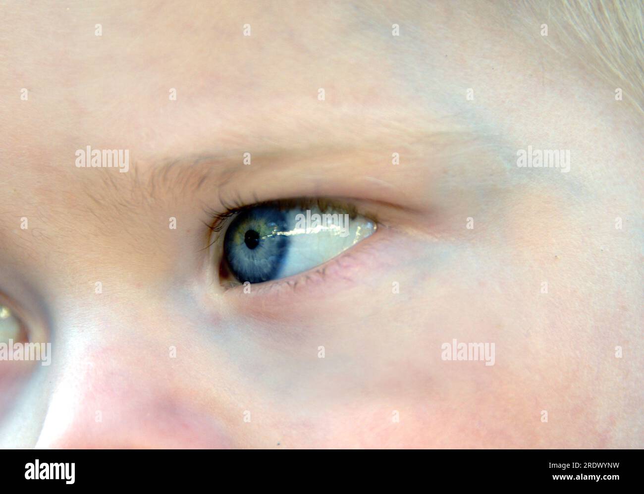 Blue eye on a baby boy glances away to the side.  Extreme closeup of infants eye. Stock Photo