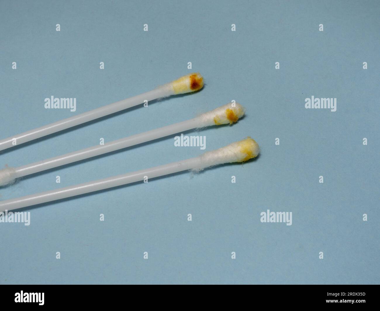 Dirty cotton swabs. Earwax on cotton swabs. Personal hygiene. Dirt from