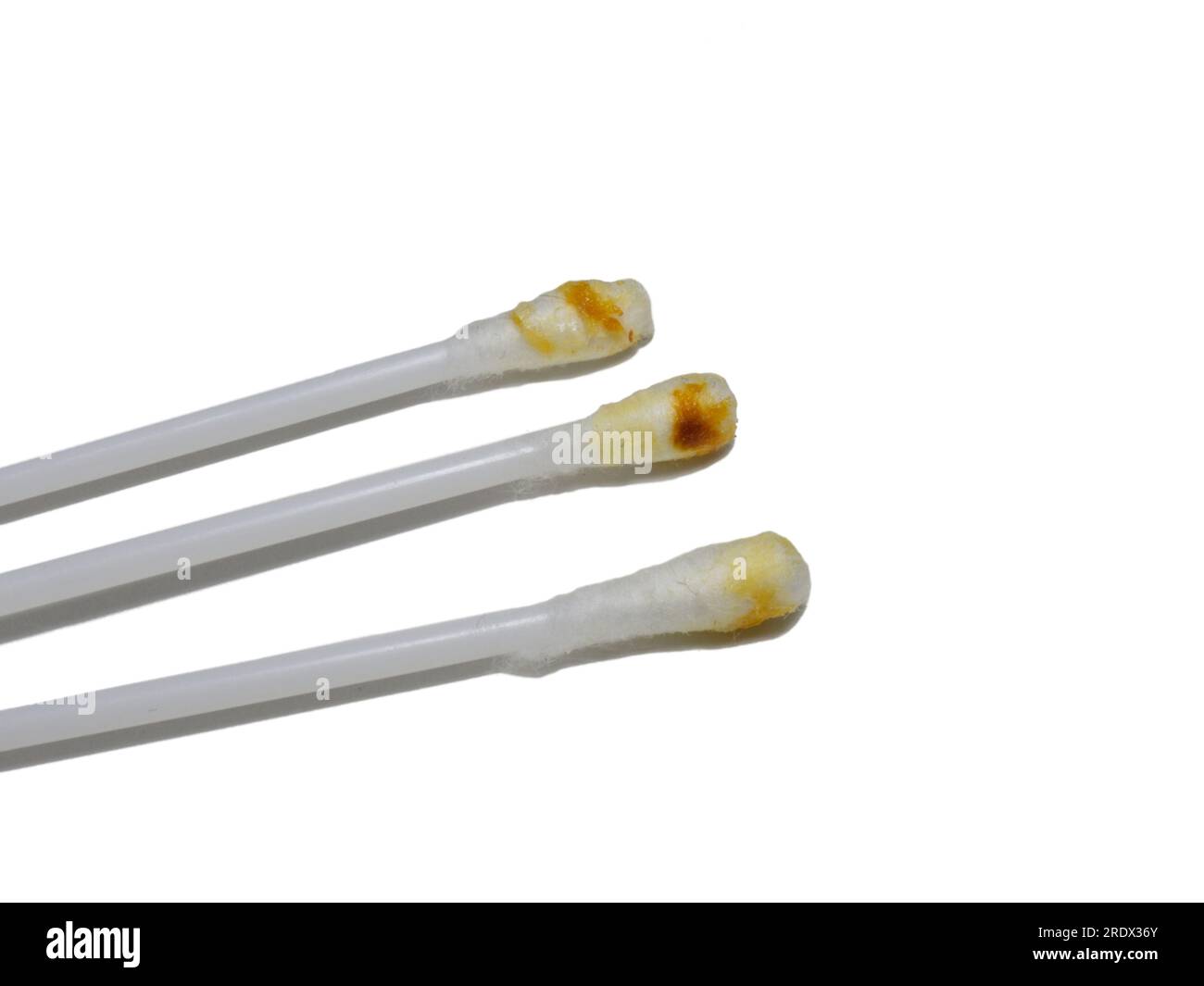 Dirty cotton swabs. Earwax on cotton swabs. Personal hygiene. Dirt from