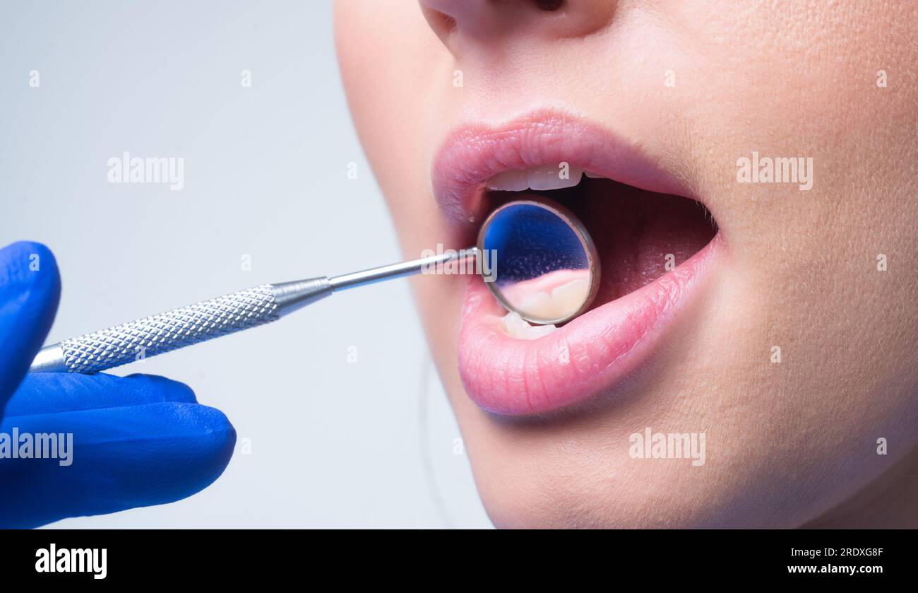 Teeth examined at dentists. Healthy woman teeth and a dentist mouth