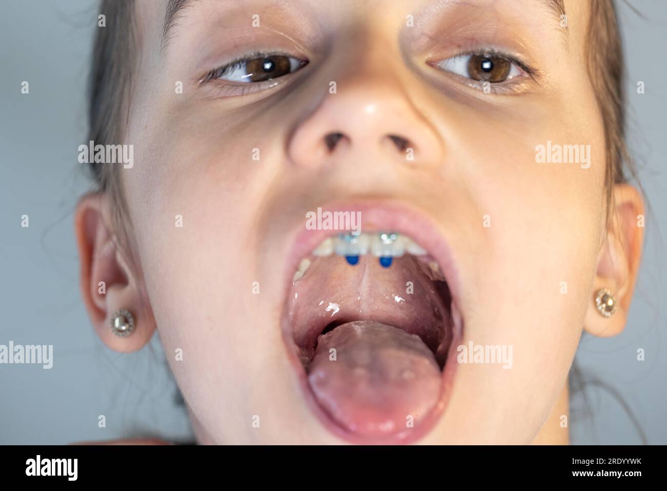 A Child Girl Open Her Mouth And Show Her Tounge Stock Photo Alamy A Child Girl Open Her Mouth And Show Her Tounge Stock Photo Alamy