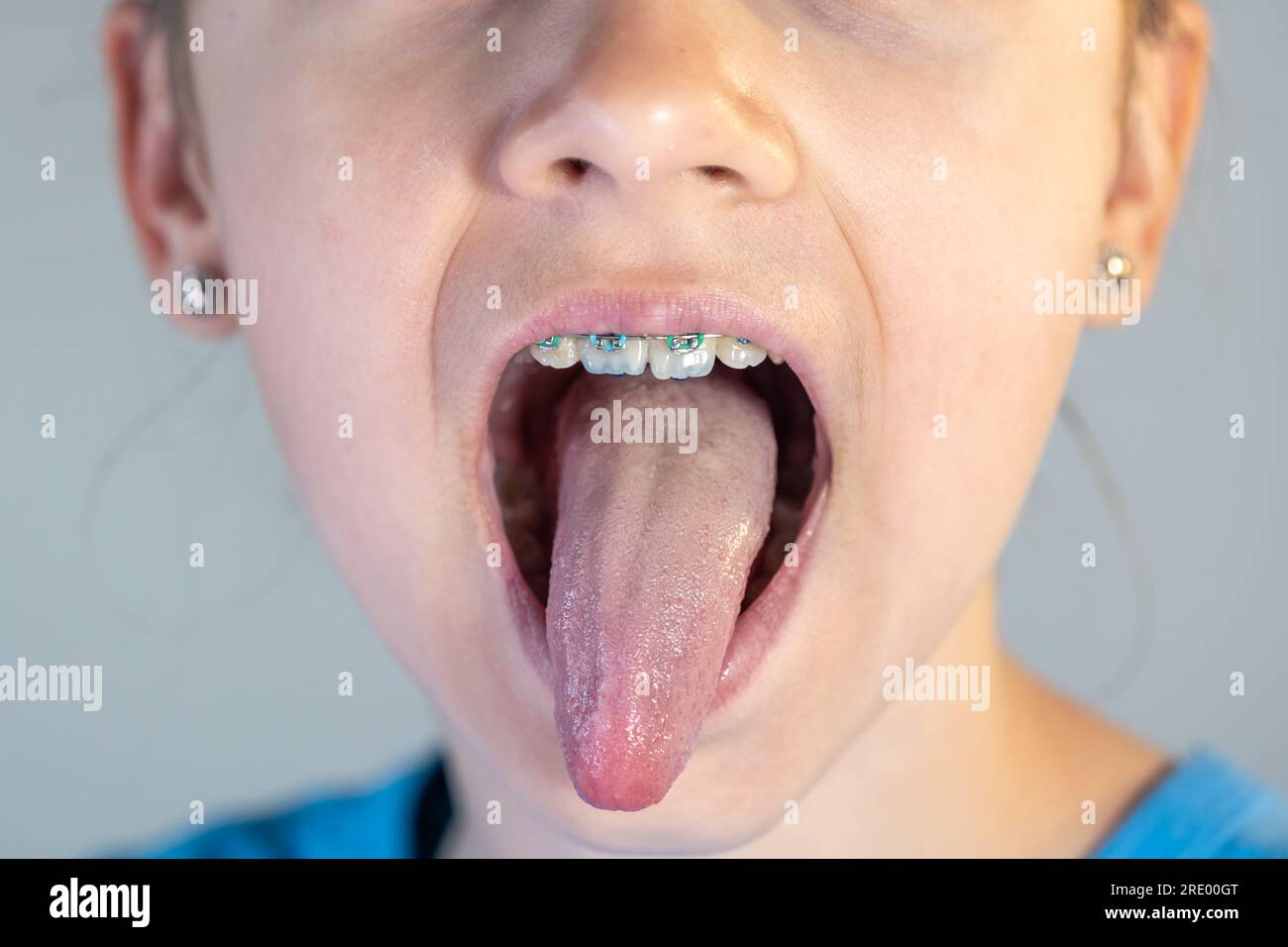 A Child Girl Open Her Mouth And Show Her Tounge Stock Photo Alamy A Child Girl Open Her Mouth And Show Her Tounge Stock Photo Alamy